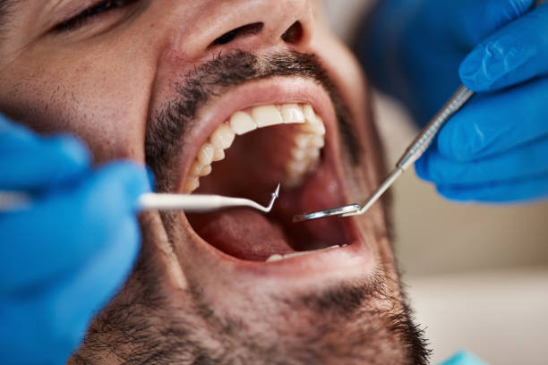 Best Emergency Dental Care for Trauma or Injury in Oakes, ND